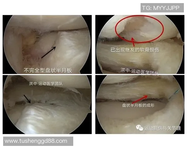 库卢塞夫斯基成功接受膝关节镜手术不再设定复出时间表